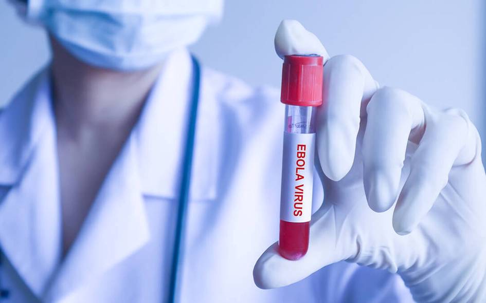 ebola-virusi-ozbekistonga-havf-solmayapti-sanepidqom