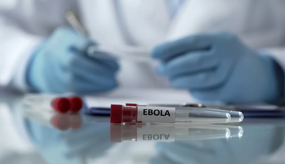 isroilda-ebola-virusiga-gumon-qilingan-birinchi-bemor-karantinga-olindi